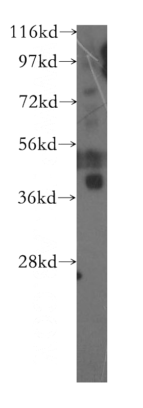 human brain tissue were subjected to SDS PAGE followed by western blot with Catalog No:107822(ABTB1 antibody) at dilution of 1:300