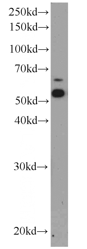 HeLa cells were subjected to SDS PAGE followed by western blot with Catalog No:108307(ATP6V1B2 antibody) at dilution of 1:3000