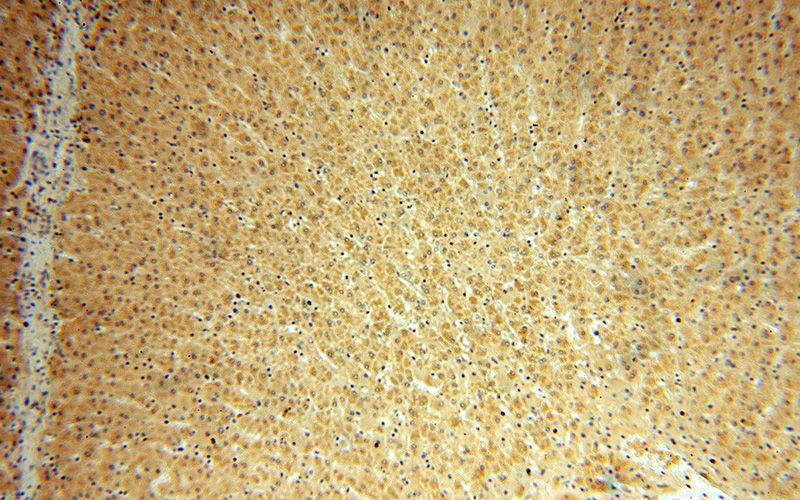 Immunohistochemical of paraffin-embedded human liver using Catalog No:115589(SRI antibody) at dilution of 1:50 (under 10x lens)