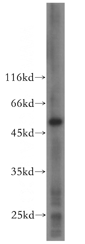 mouse ovary tissue were subjected to SDS PAGE followed by western blot with Catalog No:110004(DMKN antibody) at dilution of 1:500