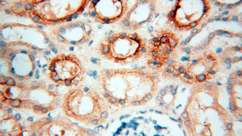 Immunohistochemical of paraffin-embedded human kidney using Catalog No:113653(PDCL2 antibody) at dilution of 1:50 (under 40x lens)