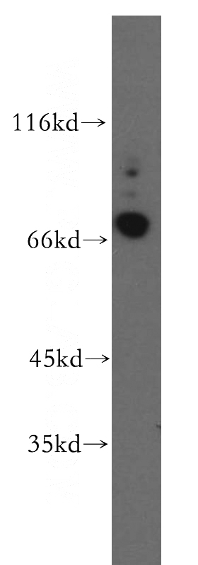 human brain tissue were subjected to SDS PAGE followed by western blot with Catalog No:109579(CRTAC1 antibody) at dilution of 1:200