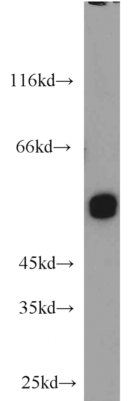 HepG2 cells were subjected to SDS PAGE followed by western blot with Catalog No:116557(UGP2 antibody) at dilution of 1:500