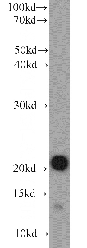 mouse heart tissue were subjected to SDS PAGE followed by western blot with Catalog No:109610(CSRP3 antibody) at dilution of 1:2000