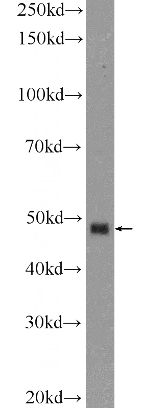 HEK-293 cells were subjected to SDS PAGE followed by western blot with Catalog No:117200(BMP7 Antibody) at dilution of 1:1000