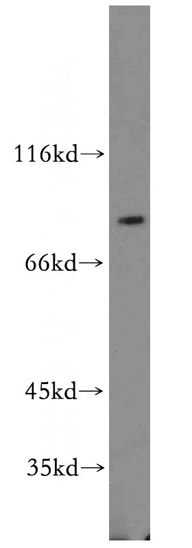 HeLa cells were subjected to SDS PAGE followed by western blot with Catalog No:110032(DTL antibody) at dilution of 1:200