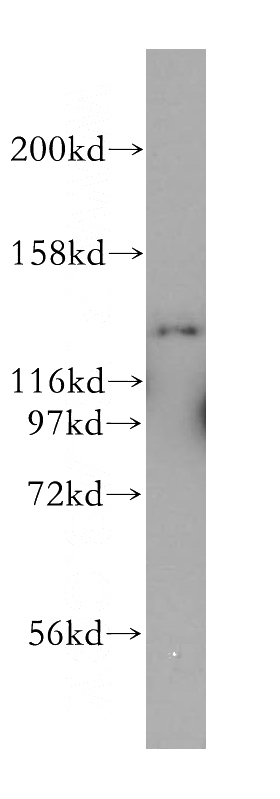 HeLa cells were subjected to SDS PAGE followed by western blot with Catalog No:112985(MYO1E antibody) at dilution of 1:500