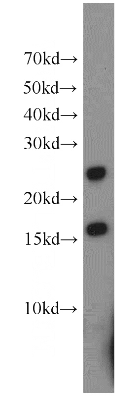mouse testis tissue were subjected to SDS PAGE followed by western blot with Catalog No:109950(DNAJC5B antibody) at dilution of 1:1500