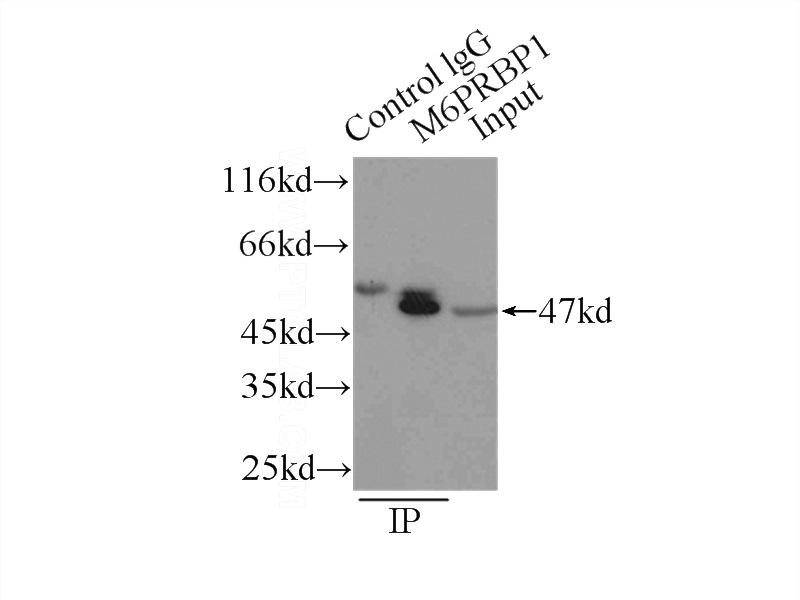 IP Result of anti-M6PRBP1 (IP:Catalog No:116063, 3ug; Detection:Catalog No:116063 1:1000) with HeLa cells lysate 1000ug.