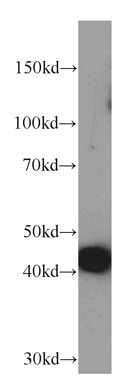 human heart tissue were subjected to SDS PAGE followed by western blot with Catalog No:107575(Actin-cardiac-muscle-1-Specific antibody) at dilution of 1:5000