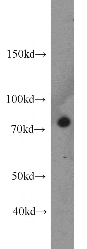 A431 cells were subjected to SDS PAGE followed by western blot with Catalog No:108833(CAPN1 antibody) at dilution of 1:1000
