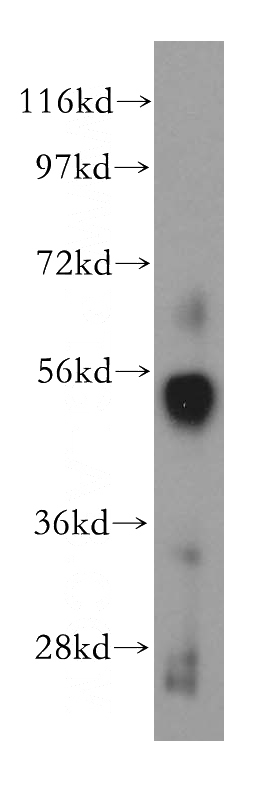 human bladder tissue were subjected to SDS PAGE followed by western blot with Catalog No:114981(SC65 antibody) at dilution of 1:400