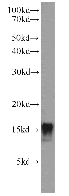 human adipose tissue were subjected to SDS PAGE followed by western blot with Catalog No:112200(LEP antibody) at dilution of 1:300