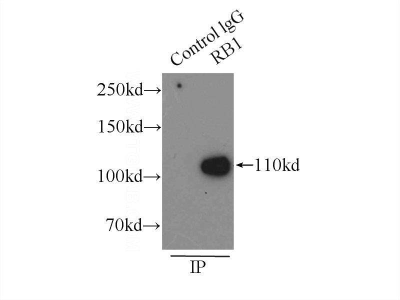 IP Result of anti-RB1 (IP:Catalog No:114489, 3ug; Detection:Catalog No:114489 1:500) with A431 cells lysate 3000ug.