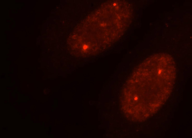 Immunofluorescent analysis of HepG2 cells, using TOE1 antibody Catalog No:116166 at 1:25 dilution and Rhodamine-labeled goat anti-rabbit IgG (red).