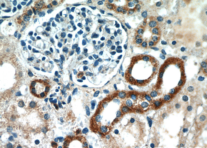 Immunohistochemical of paraffin-embedded human kidney using Catalog No:115372(SLC37A4 antibody) at dilution of 1:50 (under 40x lens)
