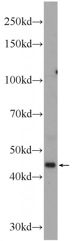 mouse small intestine tissue were subjected to SDS PAGE followed by western blot with Catalog No:110396(EPSTI1 Antibody) at dilution of 1:300