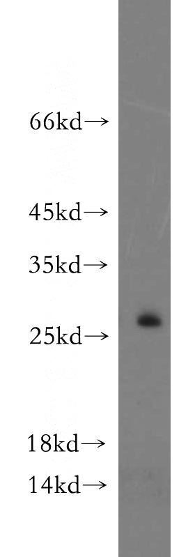 HepG2 cells were subjected to SDS PAGE followed by western blot with Catalog No:110456(FAM101A antibody) at dilution of 1:500