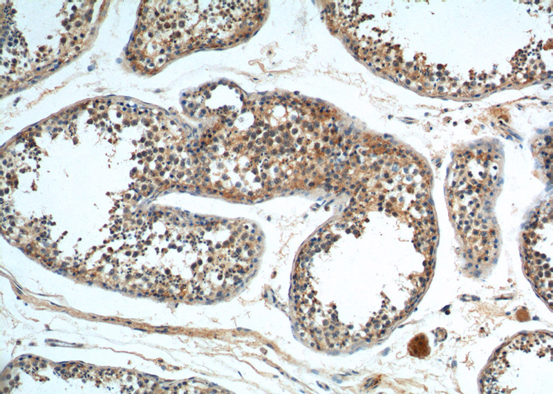 Immunohistochemistry of paraffin-embedded human testis tissue slide using Catalog No:111124(GPR22 Antibody) at dilution of 1:100 (under 10x lens).