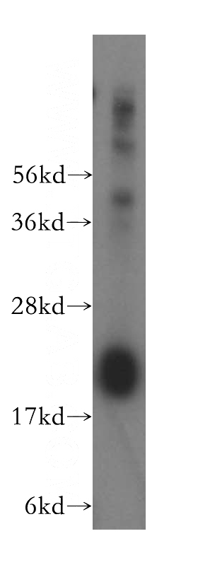 human brain tissue were subjected to SDS PAGE followed by western blot with Catalog No:109758(DCTD antibody) at dilution of 1:500