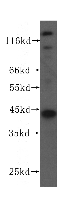A375 cells were subjected to SDS PAGE followed by western blot with Catalog No:107063(APOBEC3G antibody) at dilution of 1:200