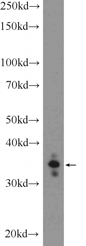 SH-SY5Y cells were subjected to SDS PAGE followed by western blot with Catalog No:113831(PHOX2A Antibody) at dilution of 1:600