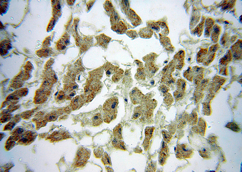 Immunohistochemical of paraffin-embedded human liver using Catalog No:117112(BDH1 antibody) at dilution of 1:50 (under 40x lens)