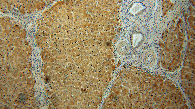 Immunohistochemical of paraffin-embedded human liver using Catalog No:107791(ADHFE1 antibody) at dilution of 1:50 (under 10x lens)