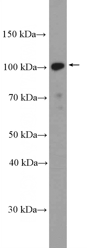 HeLa cells were subjected to SDS PAGE followed by western blot with Catalog No:117227(BRD2 Antibody) at dilution of 1:600