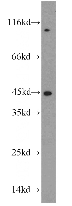 mouse liver tissue were subjected to SDS PAGE followed by western blot with Catalog No:115635(ST8SIA3 antibody) at dilution of 1:800