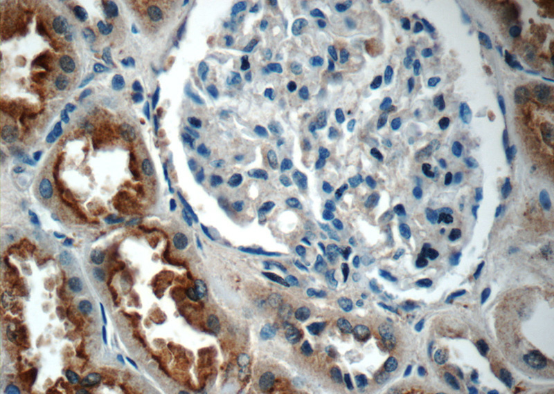 Immunohistochemistry of paraffin-embedded human kidney tissue slide using Catalog No:111827(IQSEC2 Antibody) at dilution of 1:50 (under 40x lens)