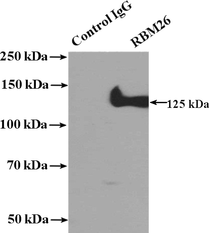 IP Result of anti-RBM26 (IP:Catalog No:114608, 4ug; Detection:Catalog No:114608 1:500) with HEK-293 cells lysate 2800ug.