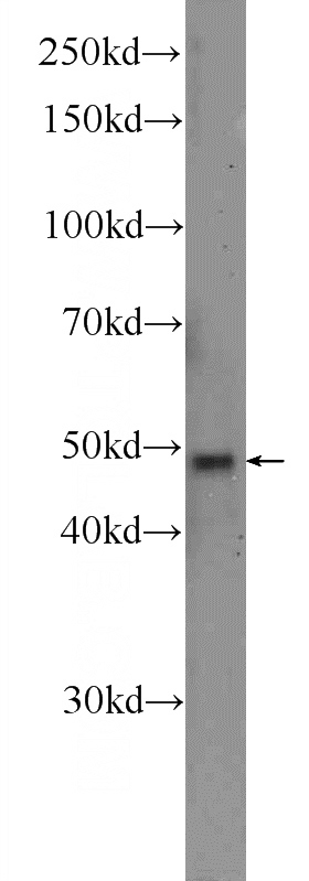 A549 cells were subjected to SDS PAGE followed by western blot with Catalog No:115019(SCRN1 Antibody) at dilution of 1:300