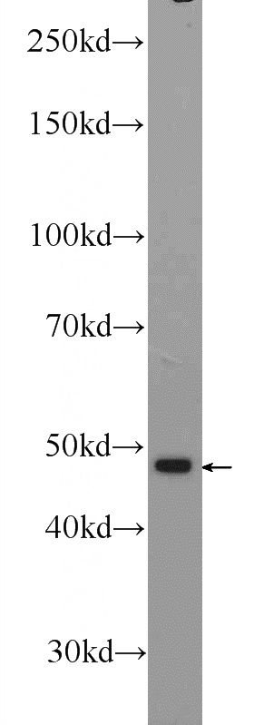 mouse kidney tissue were subjected to SDS PAGE followed by western blot with Catalog No:117161(ZNF323 Antibody) at dilution of 1:600