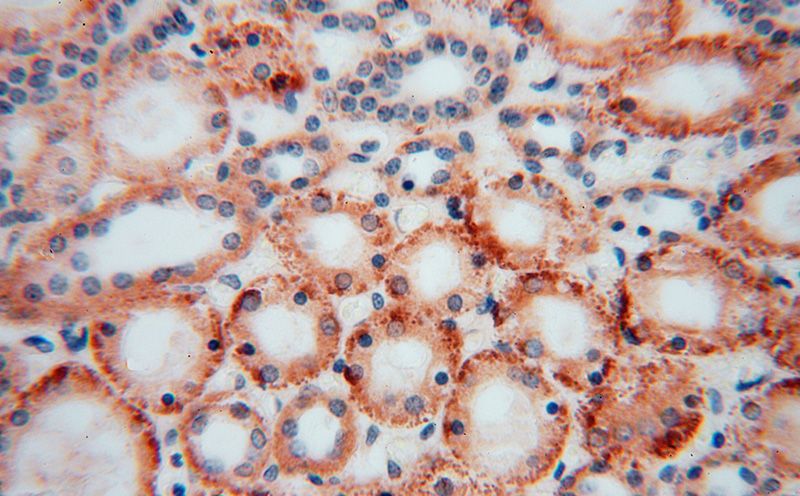 Immunohistochemical of paraffin-embedded human kidney using Catalog No:109921(DHRS1 antibody) at dilution of 1:50 (under 40x lens)