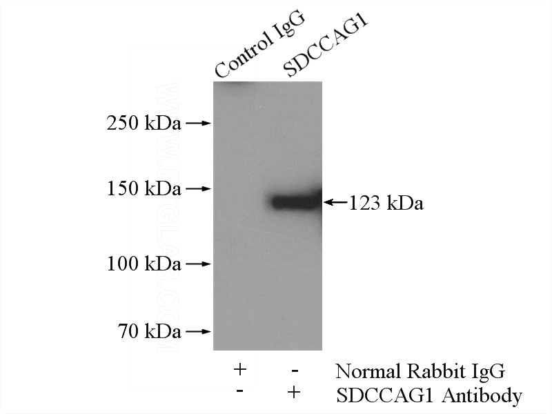 IP Result of anti-SDCCAG1 (IP:Catalog No:115025, 4ug; Detection:Catalog No:115025 1:500) with A549 cells lysate 1800ug.