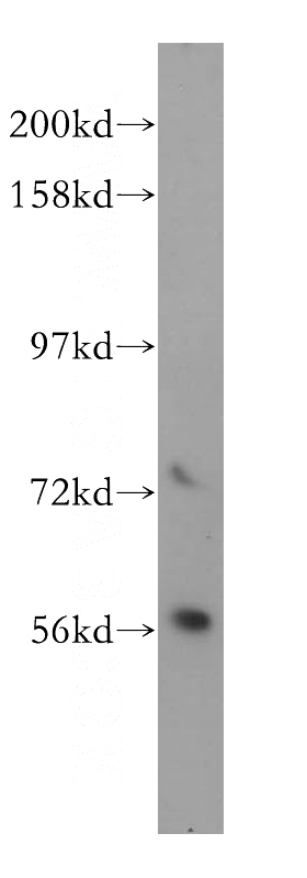 Jurkat cells were subjected to SDS PAGE followed by western blot with Catalog No:110050(DOK2 antibody) at dilution of 1:1000