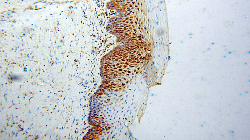 Immunohistochemical of paraffin-embedded human cervix using Catalog No:109925(DHRS4 antibody) at dilution of 1:100 (under 10x lens)