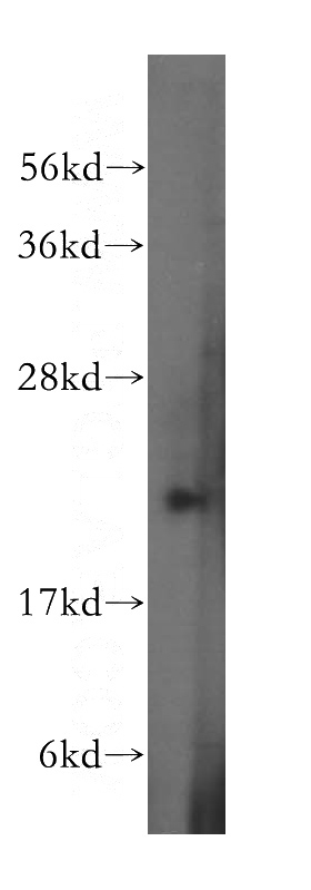 human placenta tissue were subjected to SDS PAGE followed by western blot with Catalog No:114429(RAB31 antibody) at dilution of 1:300
