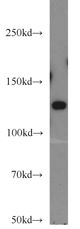 HepG2 cells were subjected to SDS PAGE followed by western blot with Catalog No:116915(ZBTB38 antibody) at dilution of 1:1000