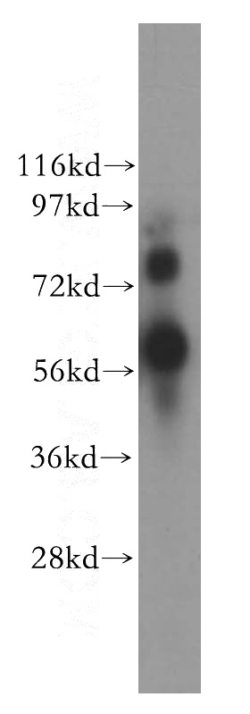 MDA-MB-231 cells were subjected to SDS PAGE followed by western blot with Catalog No:116901(YY1AP1 antibody) at dilution of 1:800