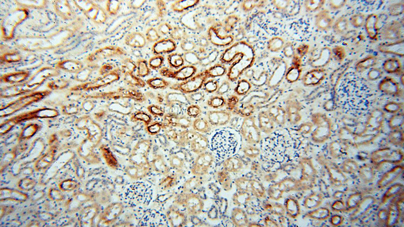 Immunohistochemical of paraffin-embedded human kidney using Catalog No:113653(PDCL2 antibody) at dilution of 1:50 (under 10x lens)