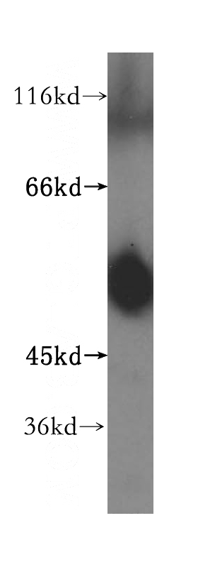 human heart tissue were subjected to SDS PAGE followed by western blot with Catalog No:108322(ATPB antibody) at dilution of 1:500