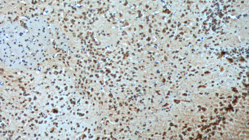 Immunohistochemistry of paraffin-embedded mouse brain tissue slide using Catalog No:107783(ADORA1 Antibody) at dilution of 1:100 (under 10x lens). heat mediated antigen retrieved with Tris-EDTA buffer(pH9).