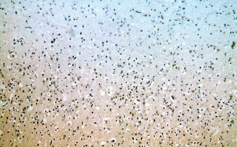 Immunohistochemical of paraffin-embedded human brain using Catalog No:111308(HEY1 antibody) at dilution of 1:100 (under 10x lens)