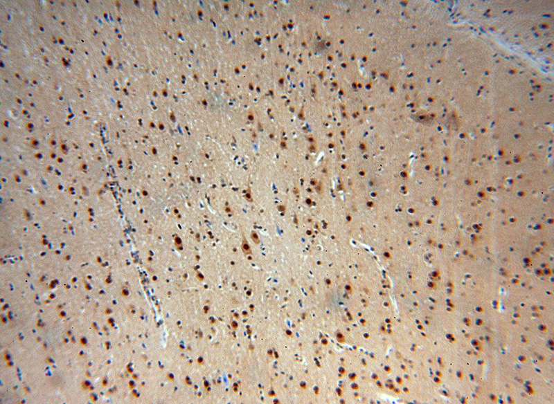 Immunohistochemical of paraffin-embedded human brain using Catalog No:114848(RSPH3 antibody) at dilution of 1:50 (under 10x lens)