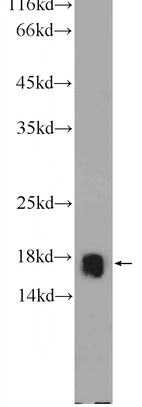 A431 cells were subjected to SDS PAGE followed by western blot with Catalog No:114877(RPL22 Antibody) at dilution of 1:600