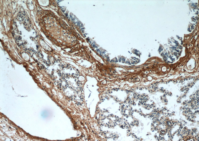 Immunohistochemical of paraffin-embedded human lung using Catalog No:113505(OGN antibody) at dilution of 1:50 (under 10x lens)