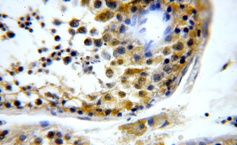Immunohistochemical of paraffin-embedded human testis using Catalog No:116460(TXNRD3 antibody) at dilution of 1:50 (under 40x lens)