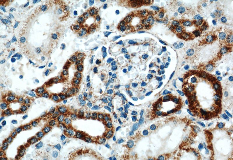 Immunohistochemistry of paraffin-embedded human kidney slide using Catalog No:108350(ATP5A1 Antibody) at dilution of 1:50
